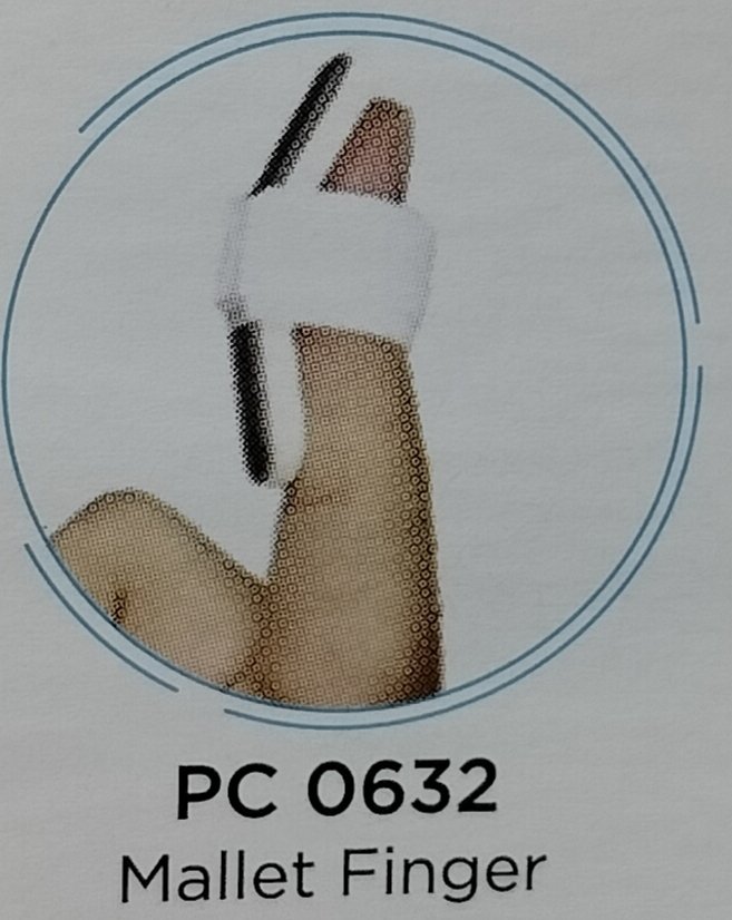 Mallet Finger UNIVERSAL PC 0632